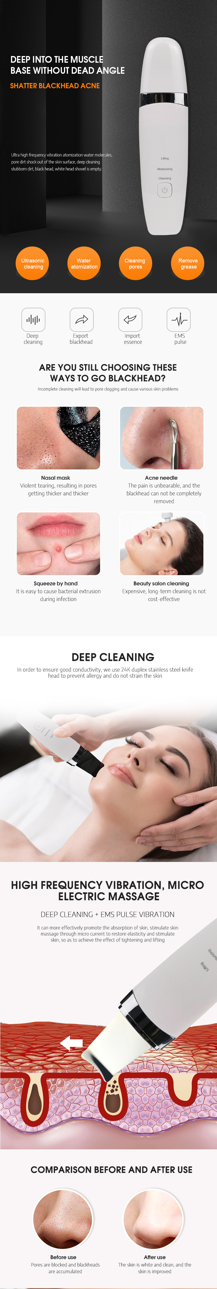 Portable ordinary peeling  face spatula derma face cleaning machine ultrasonic skin scrubber